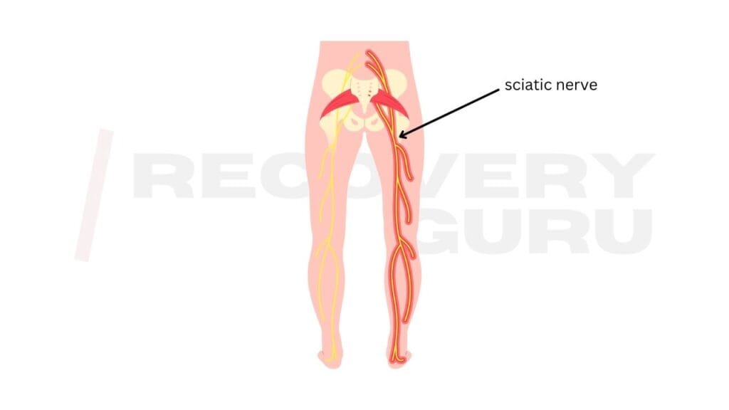 Infrared Sauna for Sciatica Treatment: Does It Work? 2 sciatica